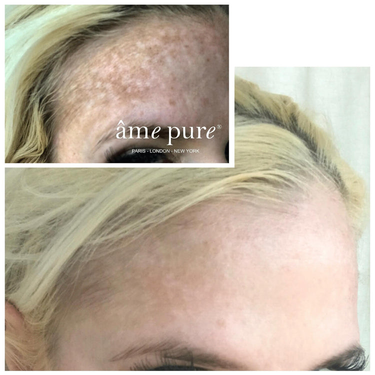 WrinklEraser™ BASIC | 2 par 1 cenu